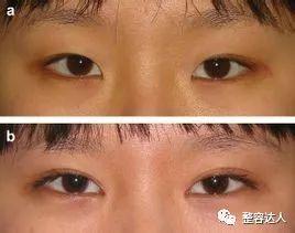 生理缺陷