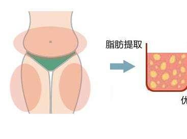 脂肪提取