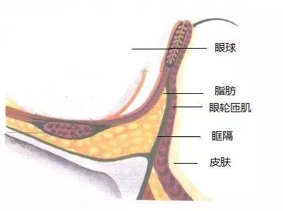 形成原因