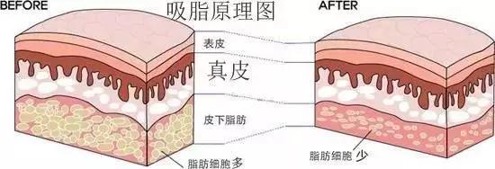 原理