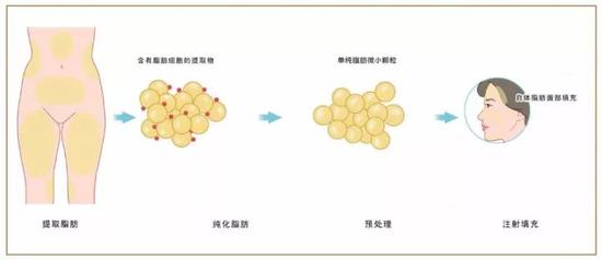 想做成那样的额头，可以吗?|丰额头|假体|毛发移植_新浪女性