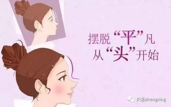 网红的额头