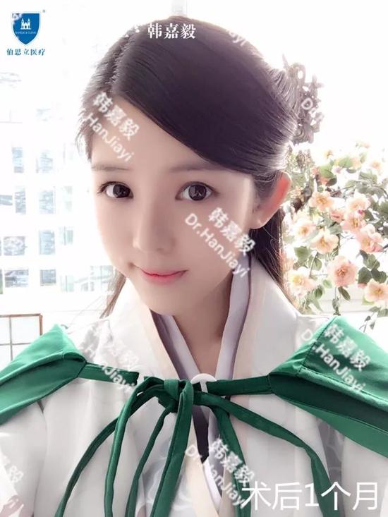 鼻中隔弯曲了还能做鼻综合手术吗?|手术|鼻中隔