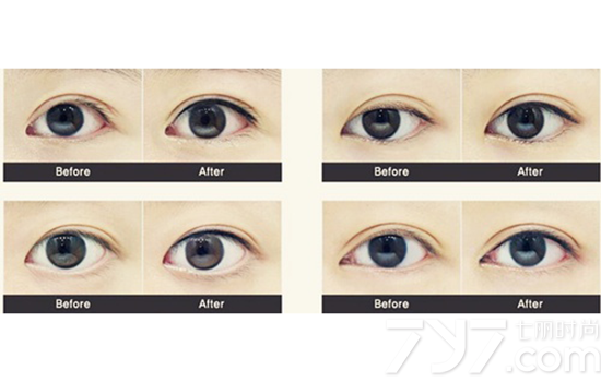 美瞳直径怎么选 多大直径最自然