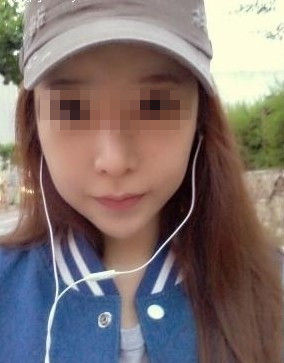 磨骨瘦脸 磨颧骨 我的脸小了一大圈