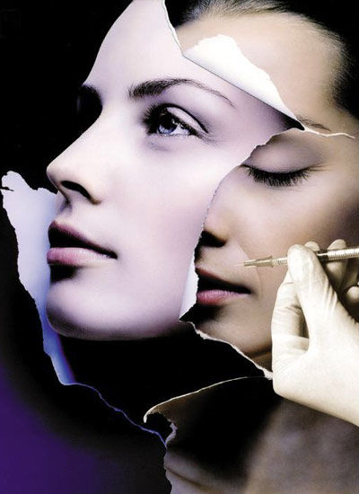 玻尿酸注射除皱 除皱补水一举两得|玻尿酸|除皱