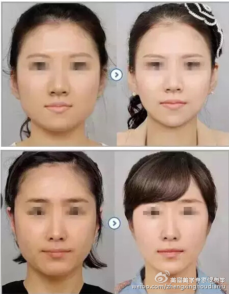 脸瘦
