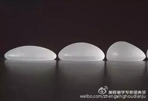 整形假体具有永久性，真的吗？