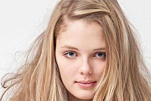 眼皮术后拆线要注意什么?|双眼皮|双眼皮拆线|