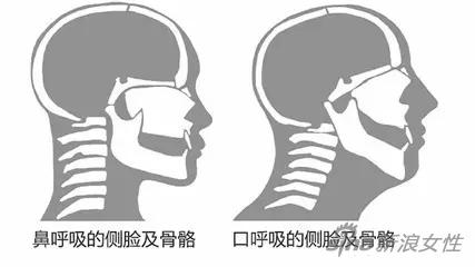 鼻呼吸姿势VS口呼吸姿势