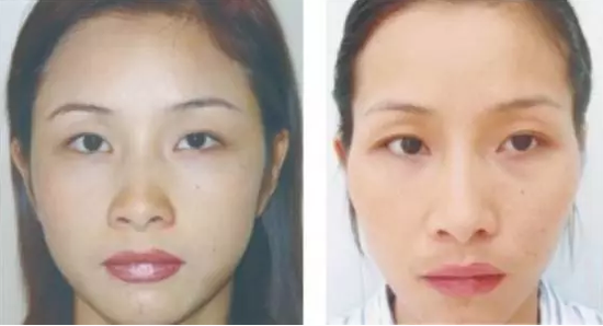 眉毛