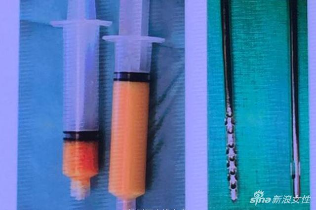 左是普通脂肪,右是纳米脂肪
