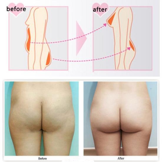 怎样可以丰臀部 BUKj-fxvecqa7580008.jpg