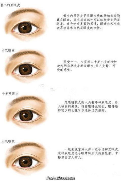 双眼皮术后为什么显得假?