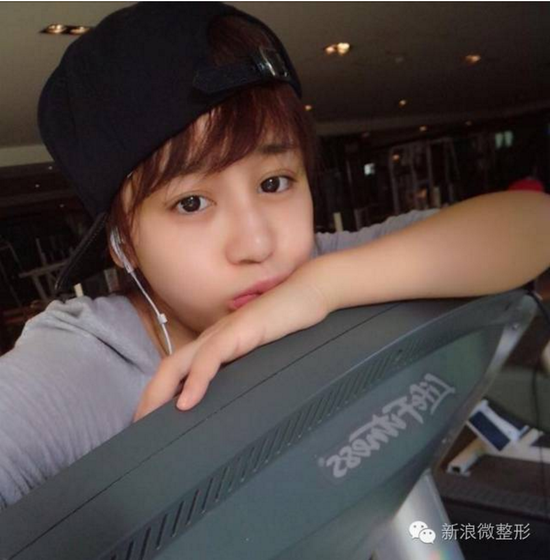 那些年被容嬷嬷扎针的紫薇们现在都怎么样了?