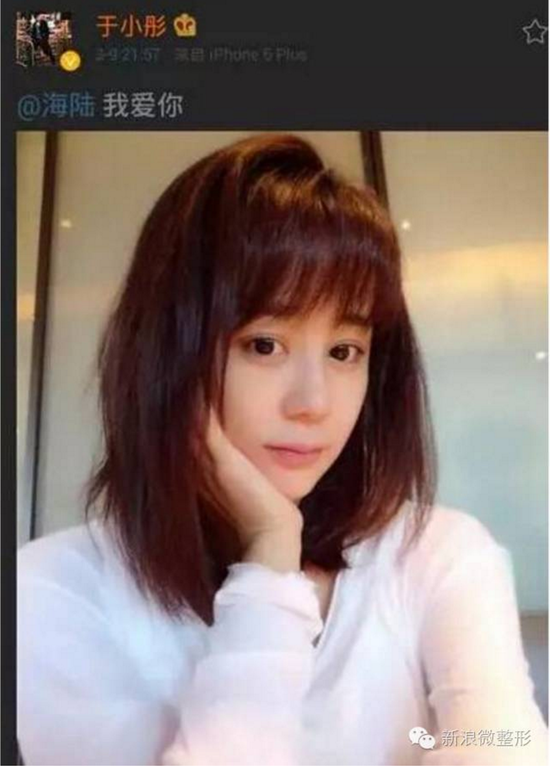 那些年被容嬷嬷扎针的紫薇们现在都怎么样了?