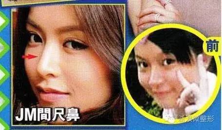文咏珊