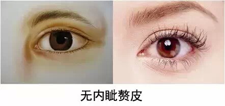 要不要开内眼角,对照一下|内眼角|内眦赘皮|眼矫正_新浪女性_新浪网