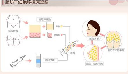 资料图