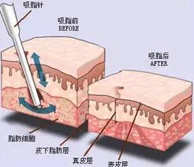 图片来源于网络