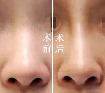 图片来源于网络