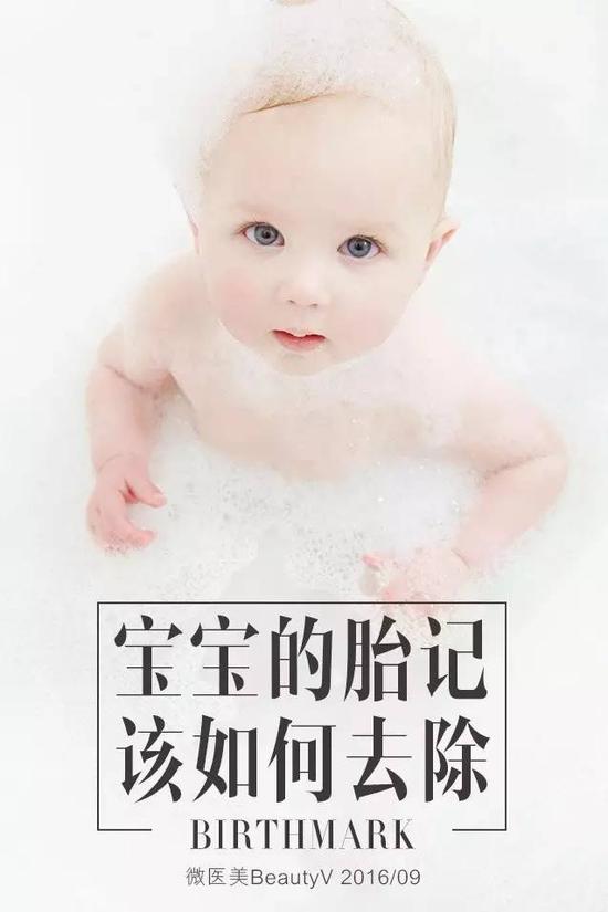新生宝宝胎记需要治疗吗? |胎记|色素|激光