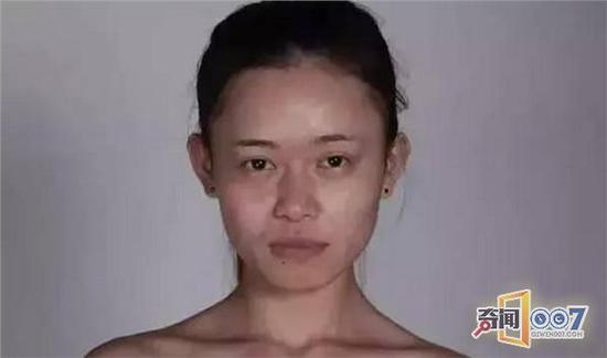 整容前