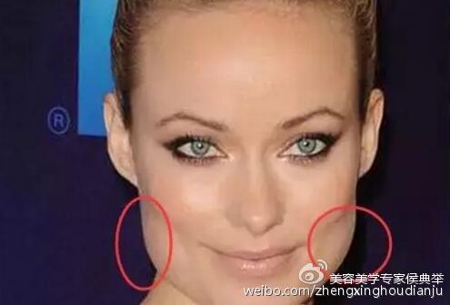 面部体重增加、宽大
