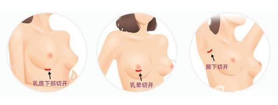 那个说蔡依林隆胸痕迹明显的直男癌患者,你已