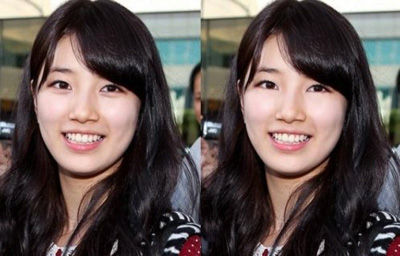 卧蚕有无对比图