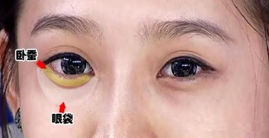 卧蚕和眼袋的位置