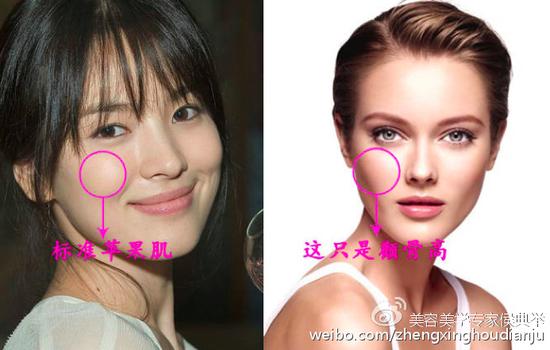 除营造亲和力和女人味外,拥有苹果肌还能无形中起到减龄效果,而向来