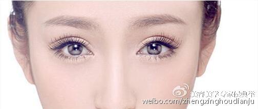 网红同款欧式大双真的好看?其实双眼皮过宽老