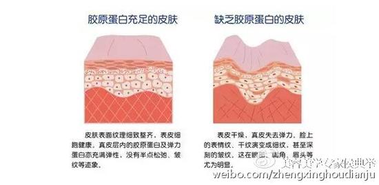 抗老化