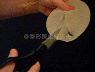 硅凝胶假体