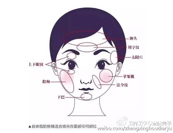 瘦就是美?瘦成这样就不一定了!|凹陷|面部|太阳