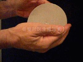 硅凝胶假体