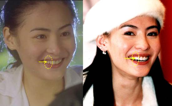 张柏芝一言不和就逆生长《喜剧之王》里的柳飘飘又回来了