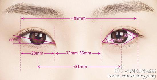 为什么要进行内眼角开大手术呢?|内眼角|内眦赘