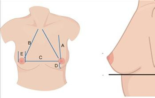 理想的乳房形态