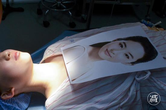 手术室里，整容手术开始了，面前的刘亦菲照片，是她的整容目标。