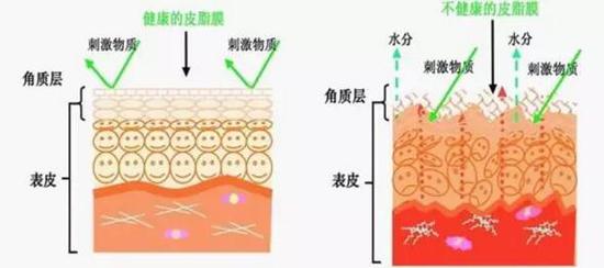 皮肤的天然屏障