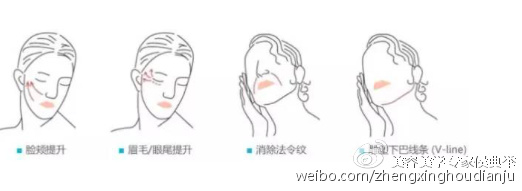 埋蛋白线