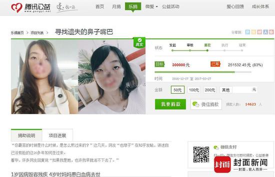 无鼻女网络求助引争议 网友:你用iphone7还缺钱