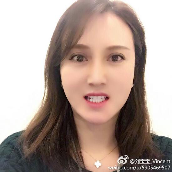 刘梓晨妈妈整容后