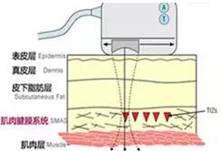 SMAS筋膜