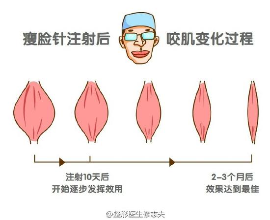 逐渐变瘦