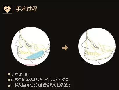 脸太大,怎样才能有效的变小、变瘦呢? - 情感天