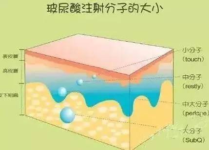 玻尿酸