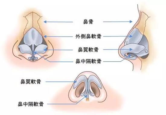 鼻整形的鼻炎患者